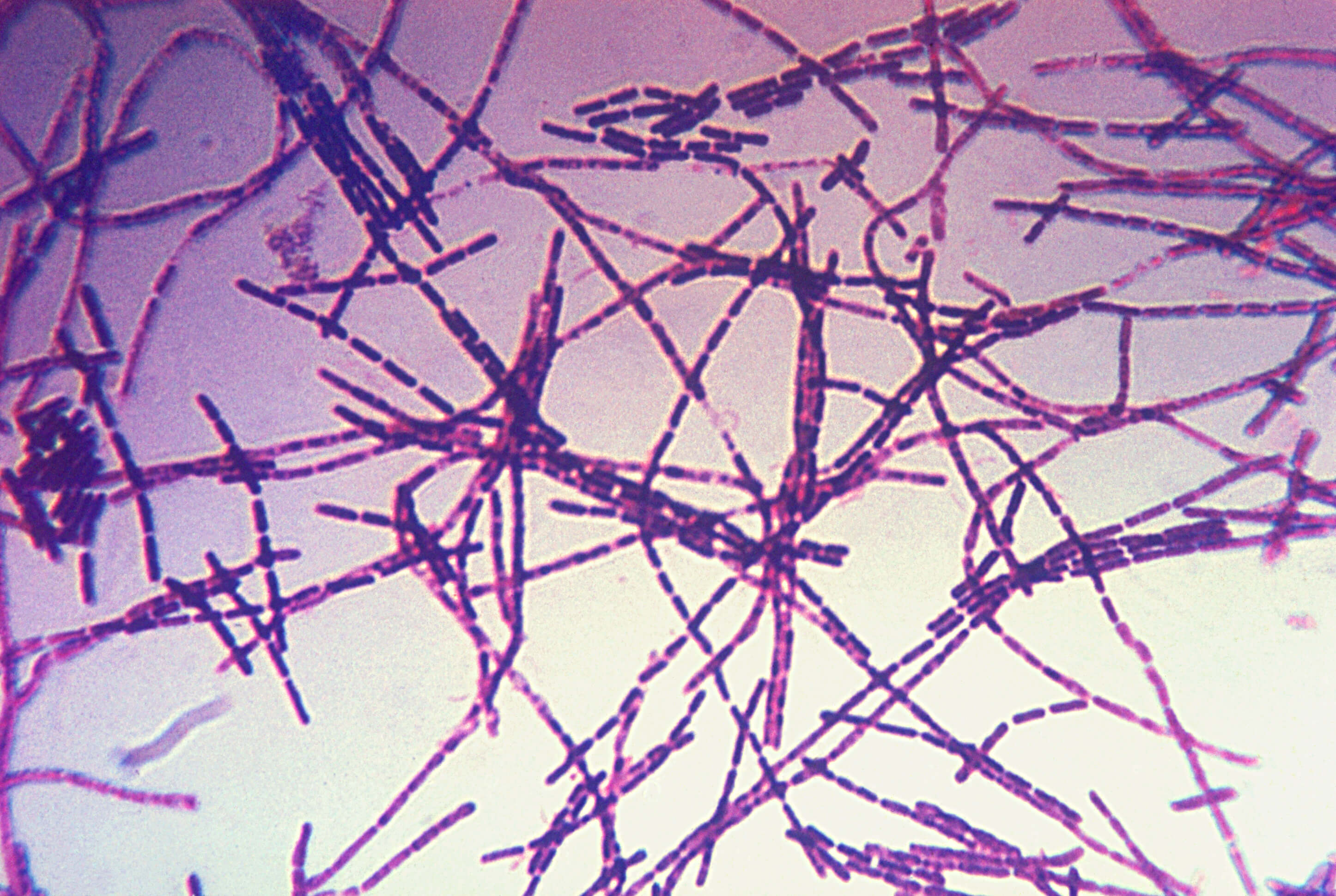 Anthrax bacteria under a microscope 
