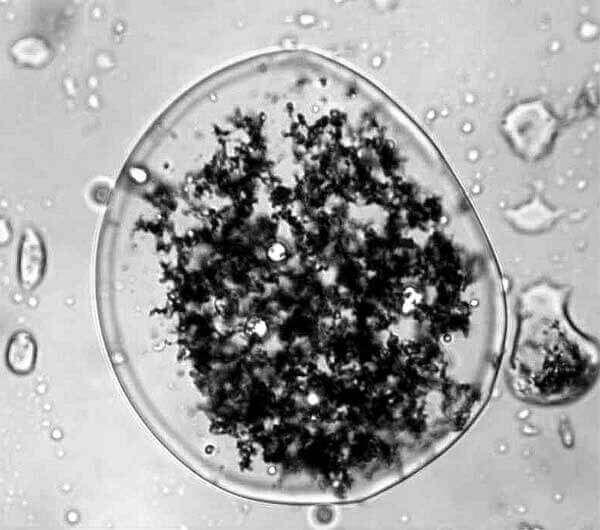 Microscopic image of emulsified zero-valent iron at work cleaning up contaminants